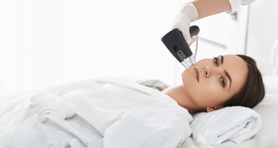 Morpheus8 Vùng Mặt