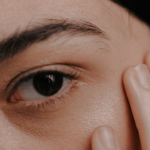 Eyes rejuvenation