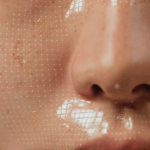 Laser Resurfacing